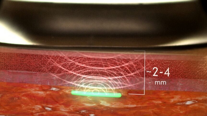 Dr Joseph Mercola : Une biopuce injectable pour la détection du SARS-CoV-2 sera prochainement approuvée par la Food and Drug Administration